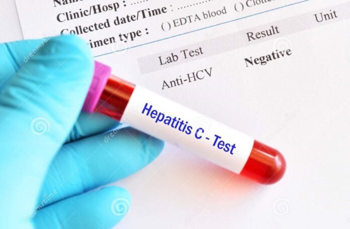 hepatitis