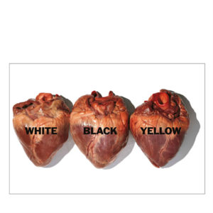 El amor es universal, no hay amor profano ni sagrado. Esta fotografía, una de las obras más icónicas y distintivas de Oliviero Toscani, fue realizada en 1991. Imagen controvertida que ha sido objeto de diversas censuras