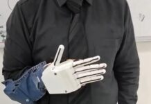 Usuario con prótesis de mano