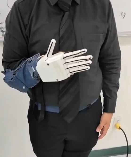 Usuario con prótesis de mano